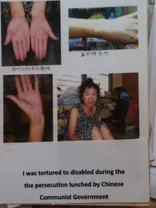 胳膊被迫害致残